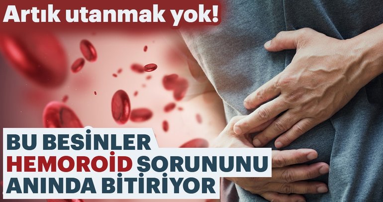 Hemoroidden kurtulmak için mutlaka