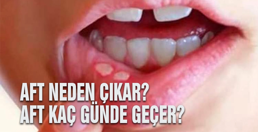 AFT NEDEN ÇIKAR AFT KAÇ GÜNDE GEÇER 2