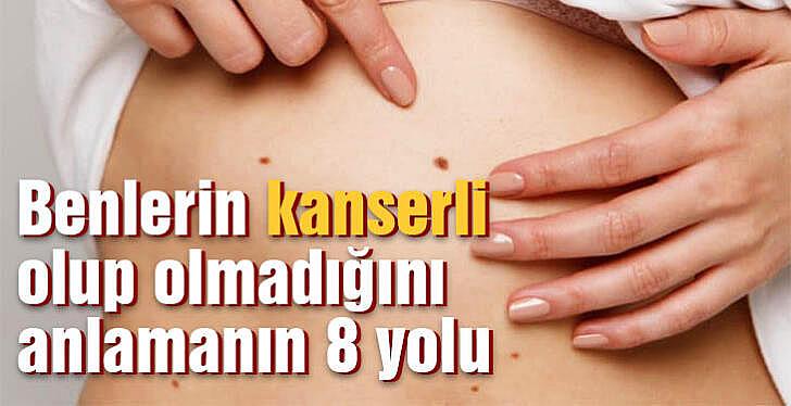 Benlerin kanserli olup olmadığını anlamanın 8 yolu